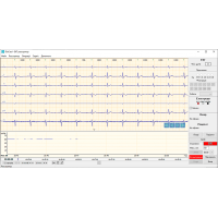 ПЗ "DiaCard – ЕКГ. Реєстратор", Windows