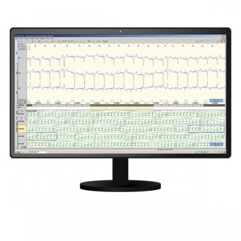 Система моніторингу  "DiaCard" 2.1 (L) з реєстратором ЕКГ 12100.01. Холтер