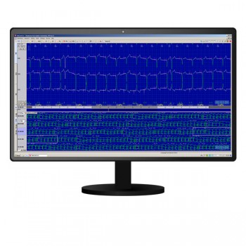 Система моніторингу "DiaCard" 2.1 (F) з реєстратором ЕКГ, АТ, РеСп, SpO2 12100.13 Холтер